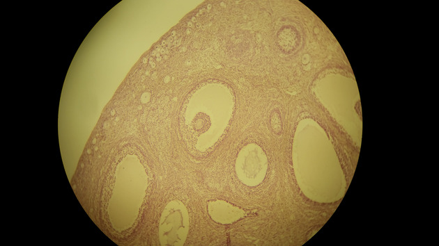 Ovary Graafian Follicle Slides - Ovary Graafian Follicle 005 100X